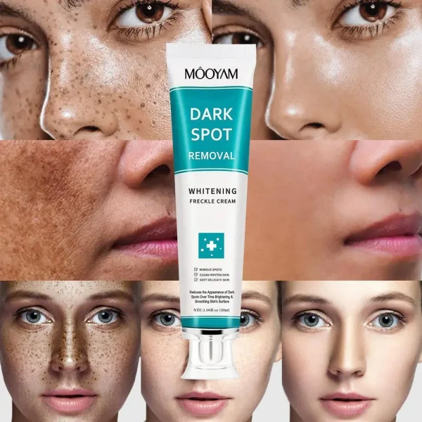 MOOYAM Dark spot removal cream - Image 2