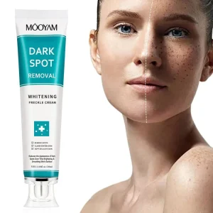 MOOYAM Dark spot removal cream