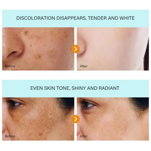 MOOYAM Dark spot removal cream - Image 5